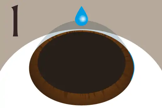 洗眼・点眼・角膜切開のイメージ画像