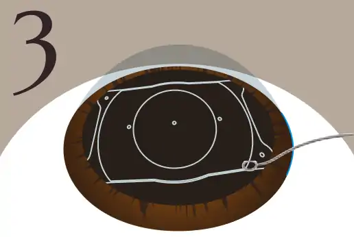 レンズ位置を調整のイメージ画像