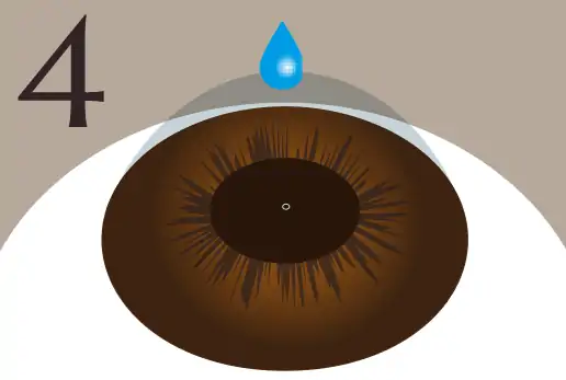 縮瞳して終了のイメージ画像